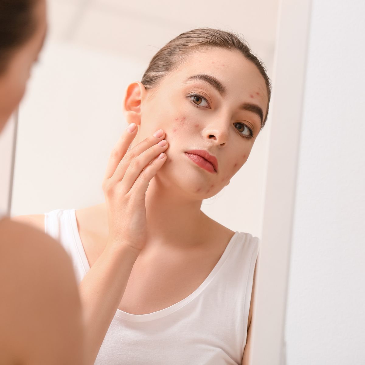 Thâm để lâu có đậm hơn không?